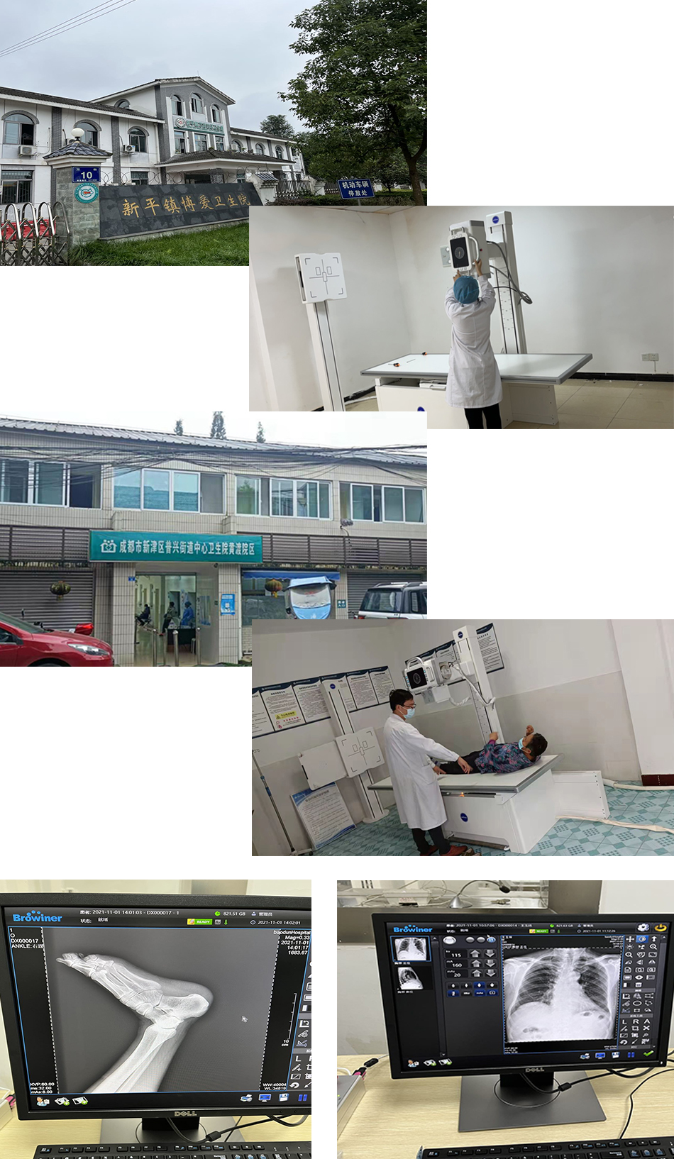 “雨润工程”系列报道——四川省基层医疗