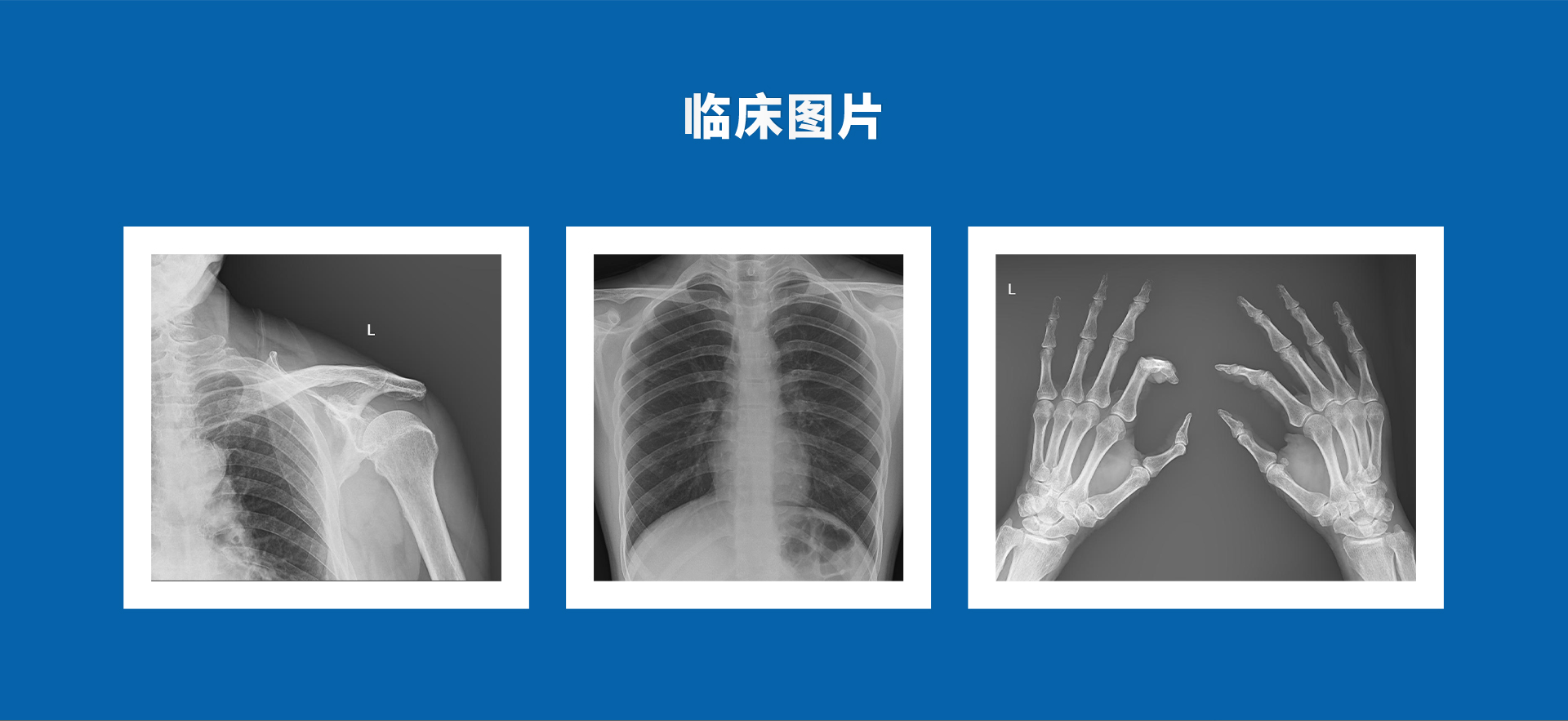 Beatle-06A 金刚石