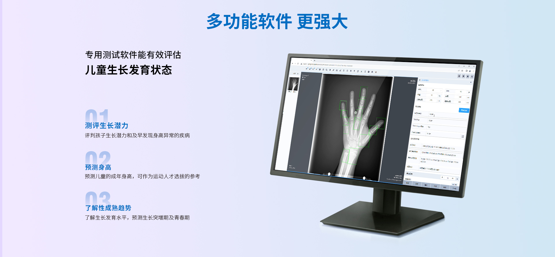 骨龄检测解决方案