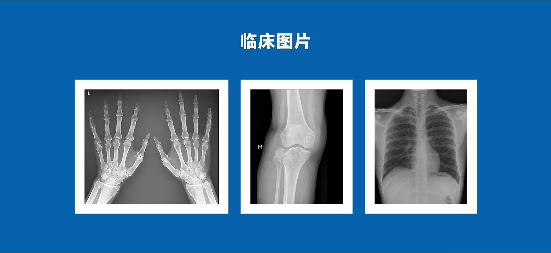 Emer DR 珍珠