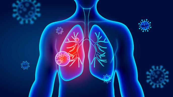 世界防治结核病日 | 宝润DR精准影像，让结核无处遁形