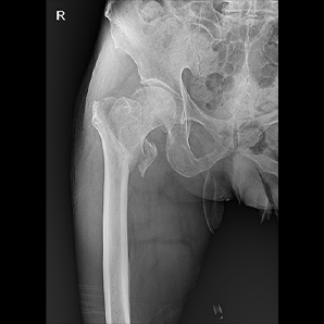 MobileSparkler系列