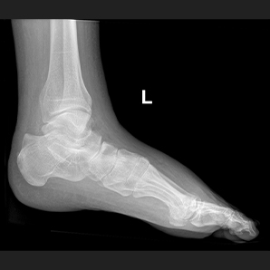 MobileSparkler系列